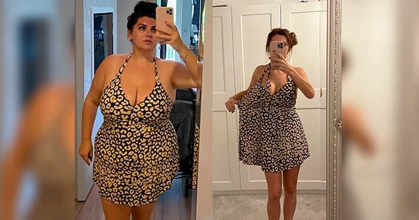 Vittaburn™ Customer